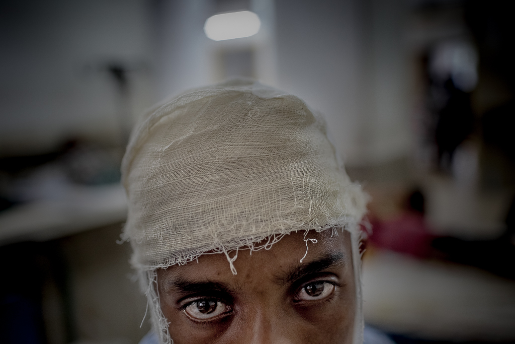 Sayad Amin, 20 is from Maungdaw, Myanmar; admitted to the Cox’s Bazar Sadar City Hospital. He witnessed the violence that the Mog (Arakan Buddhists) and Myanamr military did. After fleeing Myanmar when he came to the makeshift camp in Cox’s Bazar, he fell into a fight with old Rohingya refugees (who came in Bangladesh previously). One of the old Rohingya hit his head and he got injured.